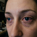 Fini les yeux qui brûlent